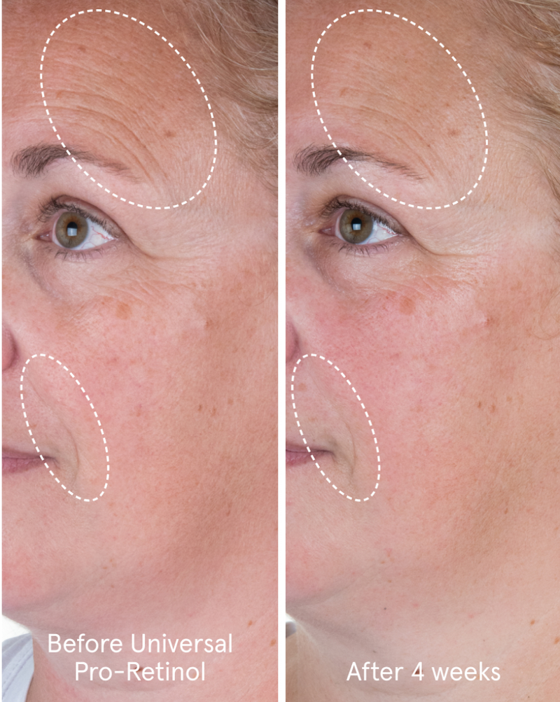 Universal Pro-Retinol