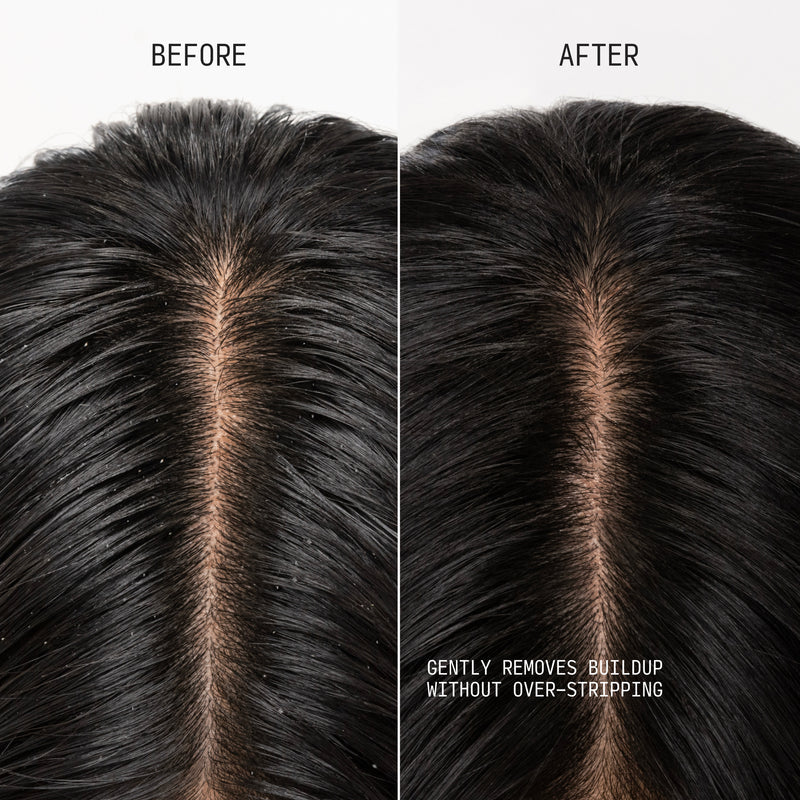 Clarifying Shampoo & Scalp Scrub Max Size