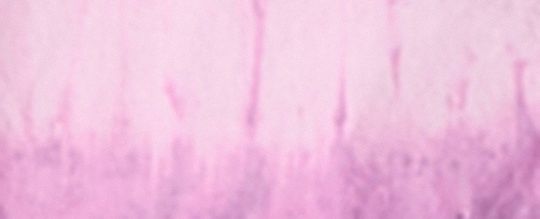 Restored Tie-Dye Sleeveless Dress