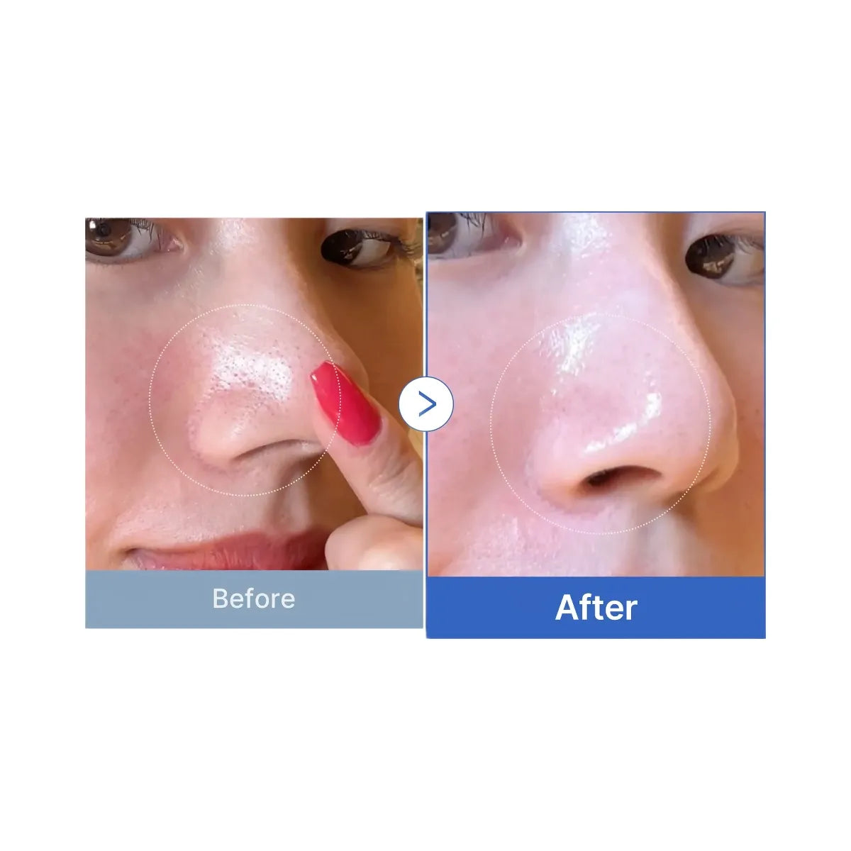 Medicube Zero Pore Pads 2.0