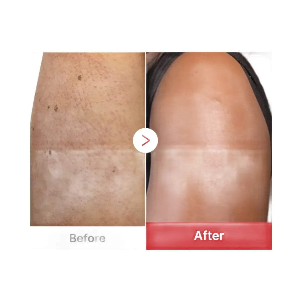 Medicube Hypochlorous Acid Rice Body Peel Shot