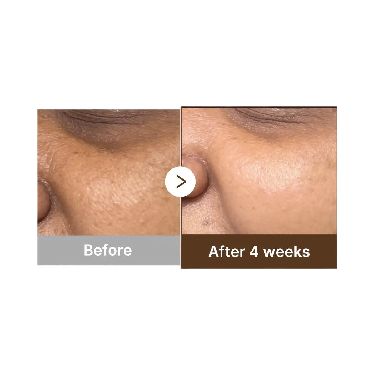 Medicube Deep Vitamin C Capsule Serum