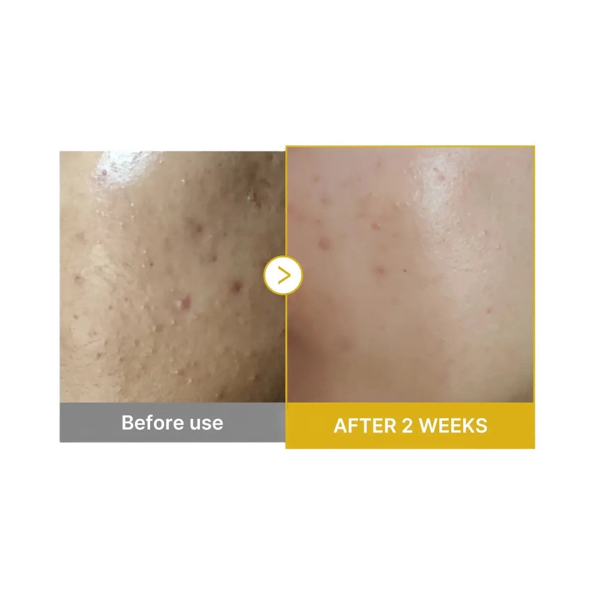 Medicube Kojic Acid Turmeric Peel Shot