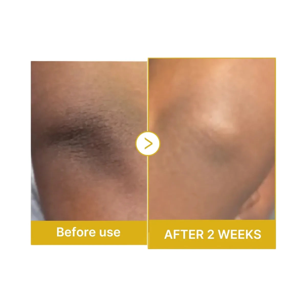 Medicube Kojic Acid Turmeric Body Peel Shot