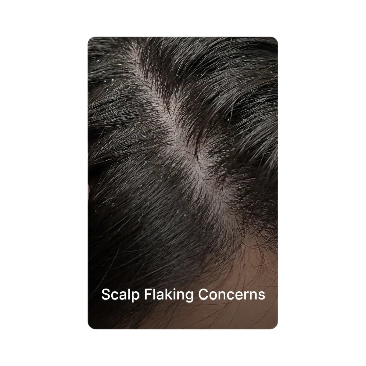 Medicube Rosemary PDRN Scalp Serum