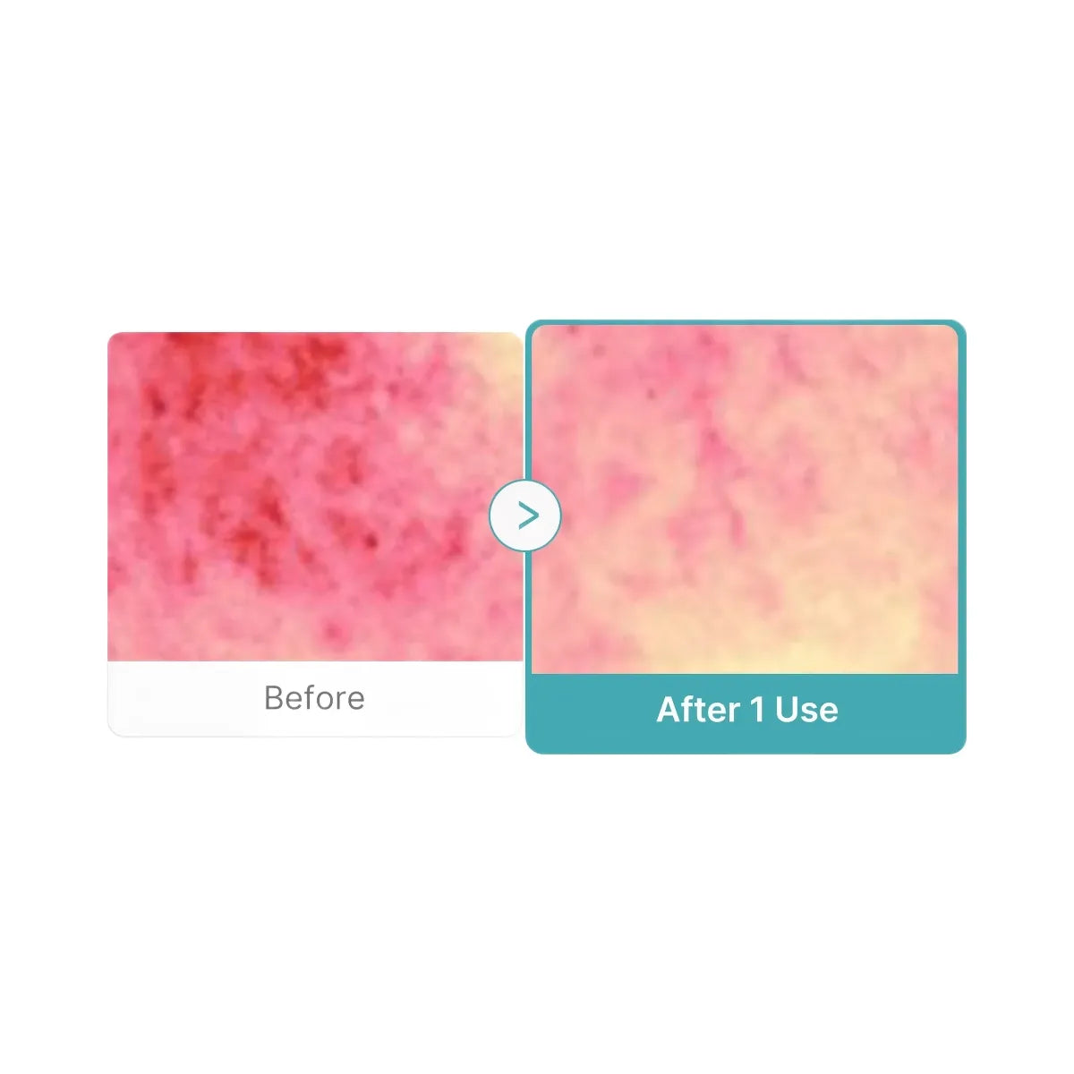Medicube Azelaic Acid Capsule Foam Cleanser