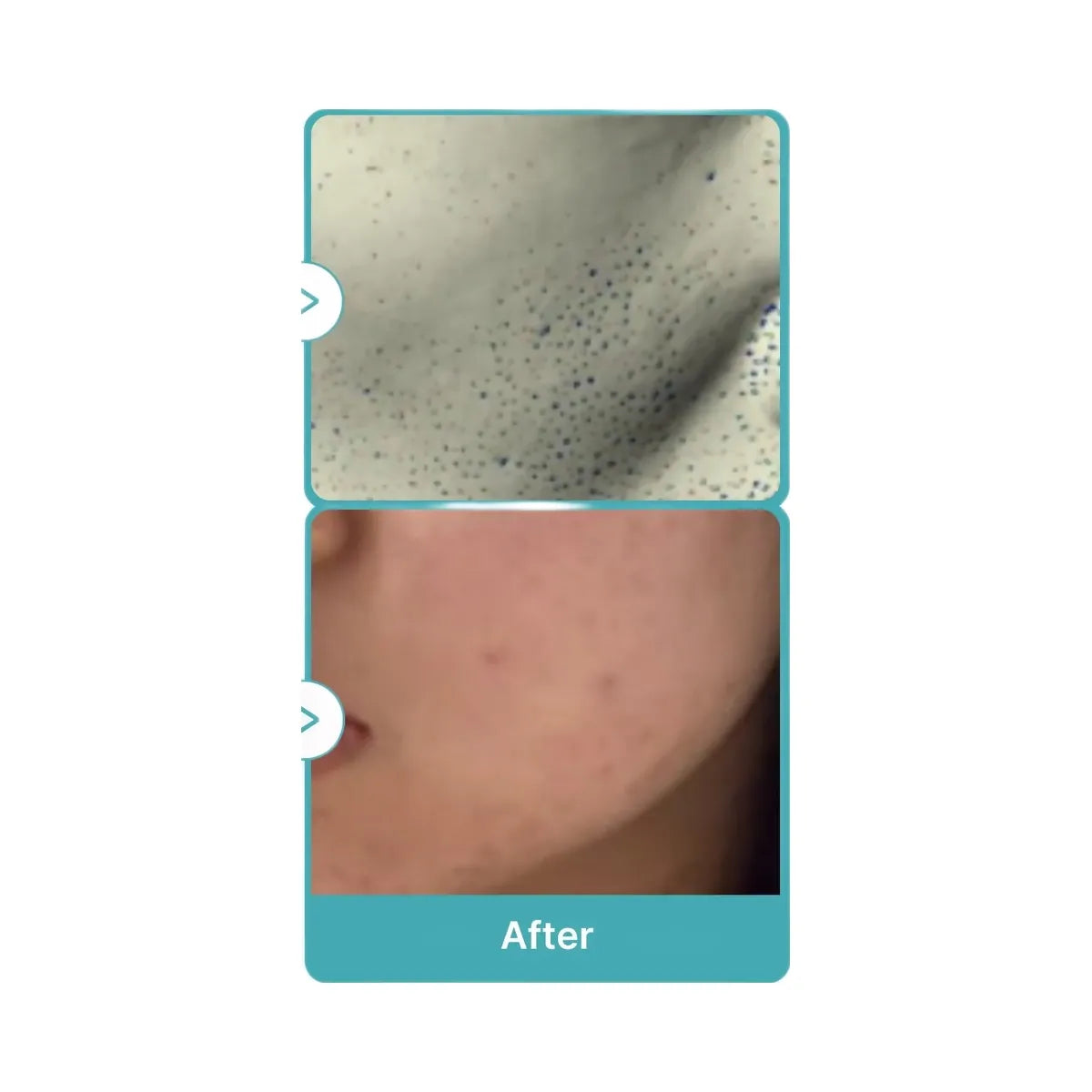 Medicube Azelaic Acid Niacinamide Clarifying Toner