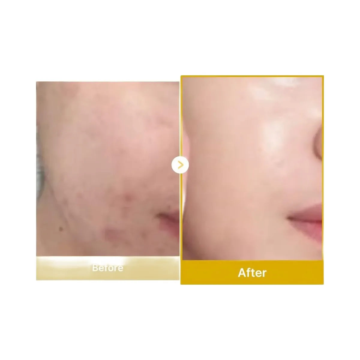 medicube Kojic Acid Turmeric Night Wrapping Mask