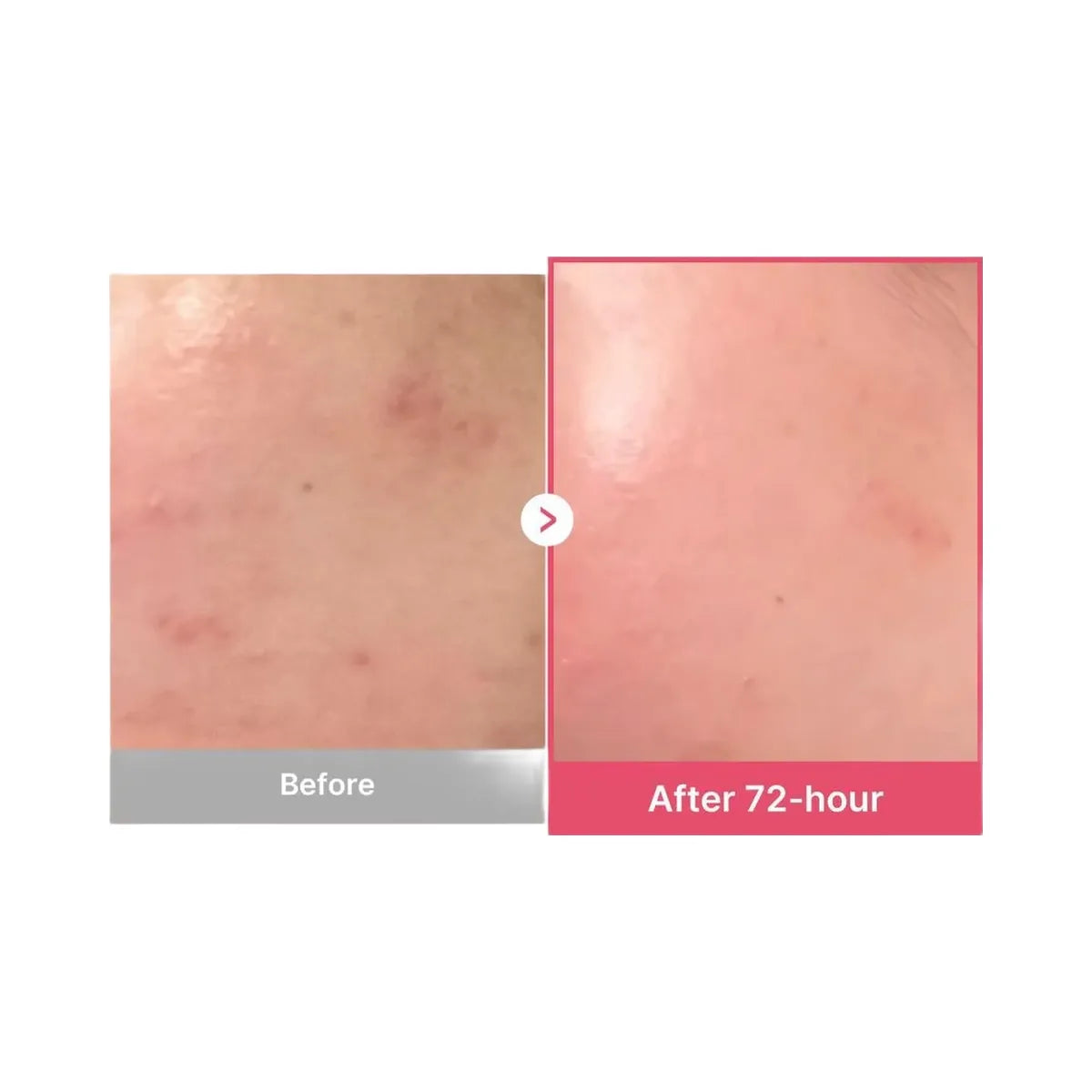 medicube TXA Niacinamide 15% Serum