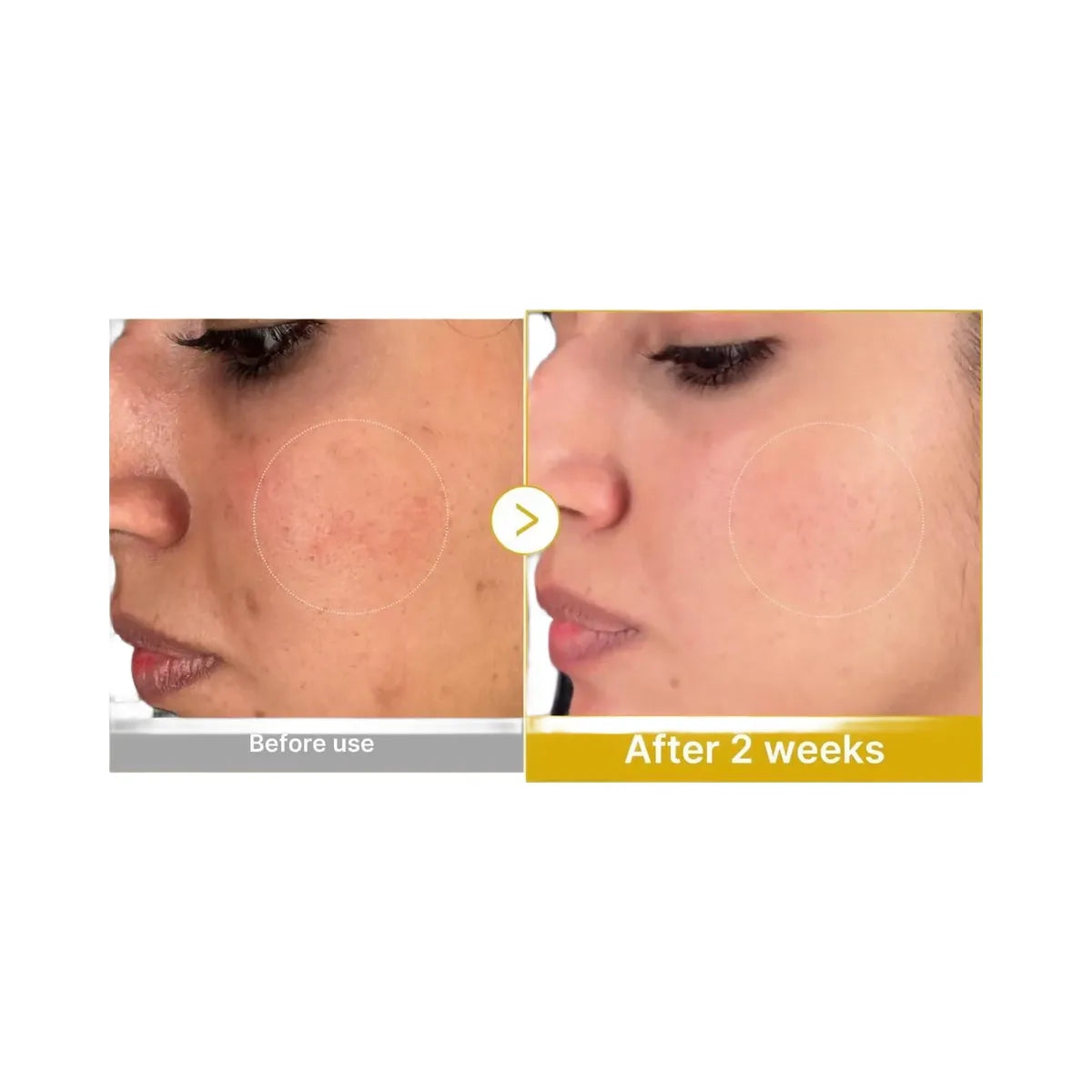 medicube Kojic Acid Turmeric Resurfacing Toner