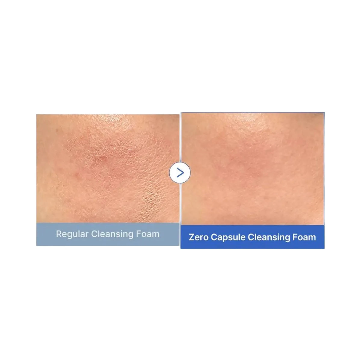 medicube Zero Pore SA Clear Capsule Facial Deep Cleanser