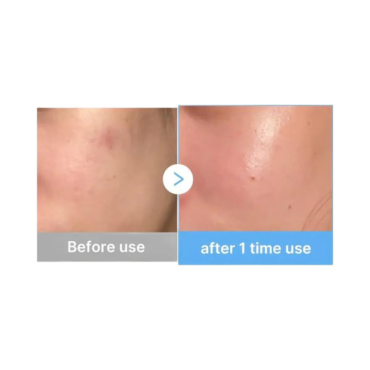 medicube Hyaluronic Multi Peptide Serum