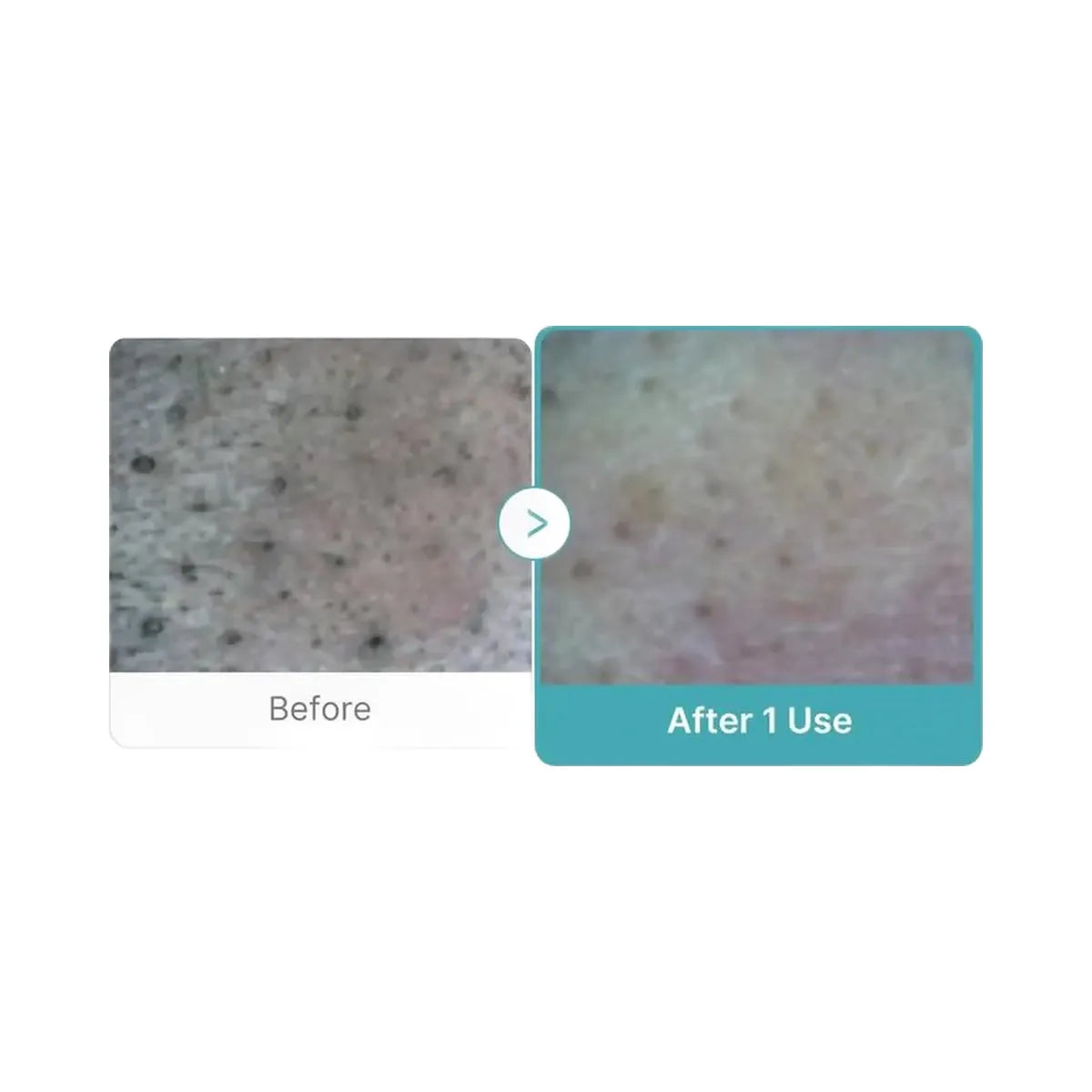 medicube Azelaic Acid Niacinamide Deep Clean Whip Cleanser