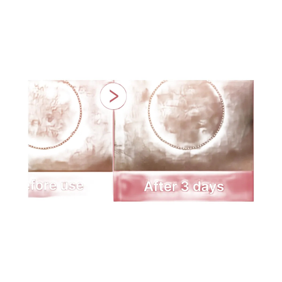 Medicube PDRN Pink Collagen Capsule Cream