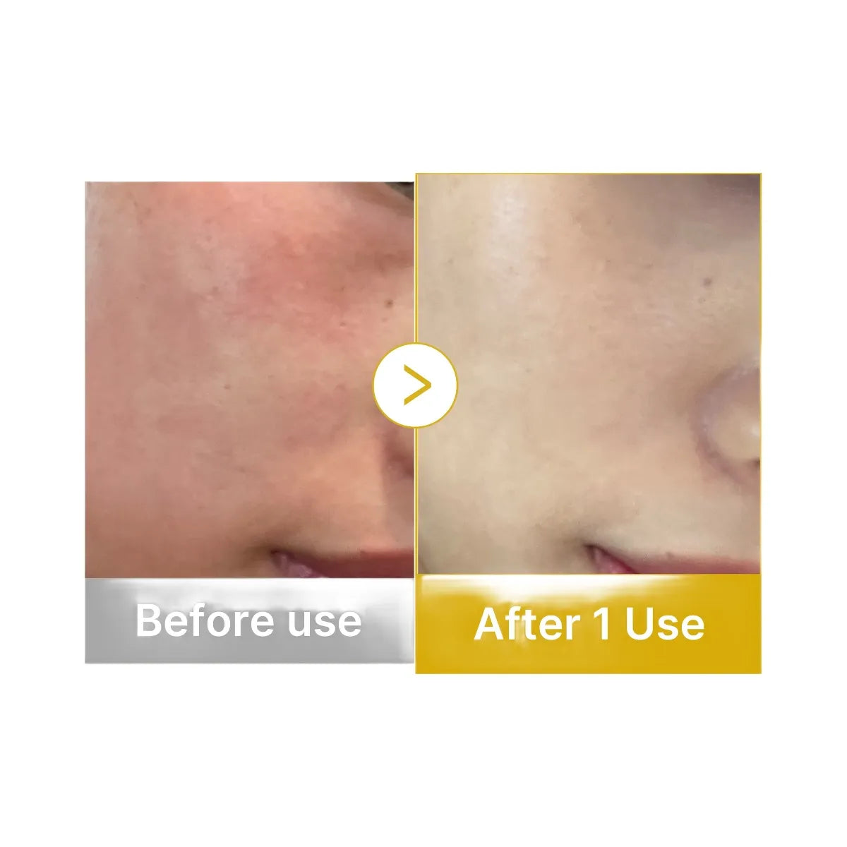 Medicube Kojic Acid Turmeric Vitamin Gold Jelly Mist Serum