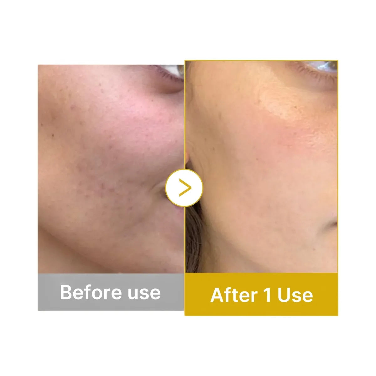 Medicube Kojic Acid Turmeric Vitamin Gold Jelly Mist Serum
