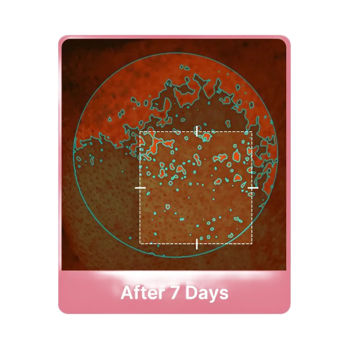 Medicube PDRN Pink Collagen Gel Toner Pad