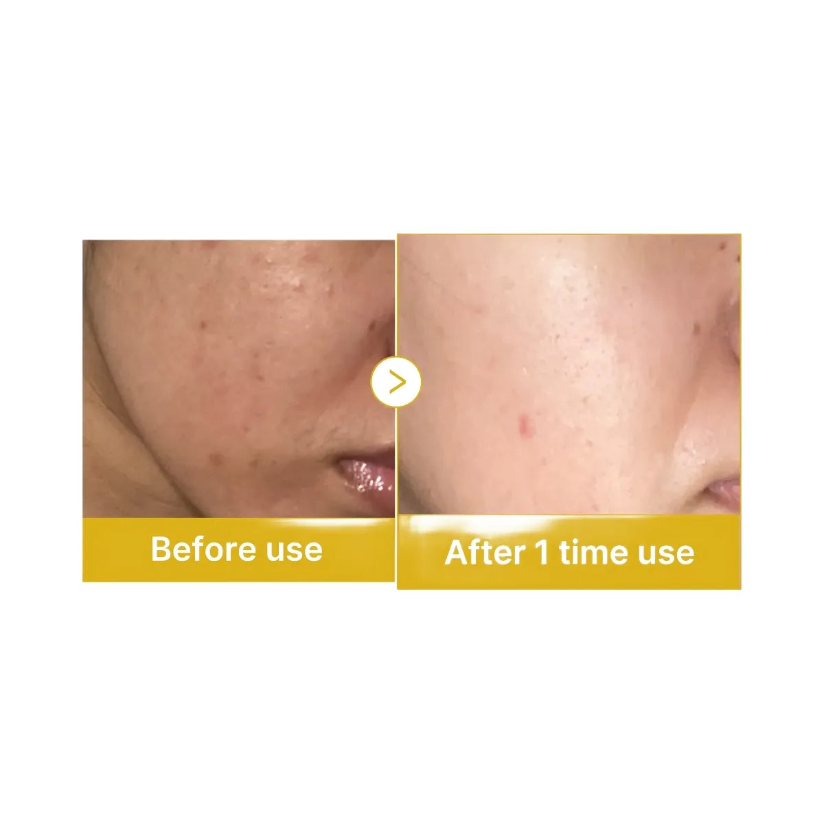 Medicube Kojic Acid Turmeric Overnight Wrapping Mask