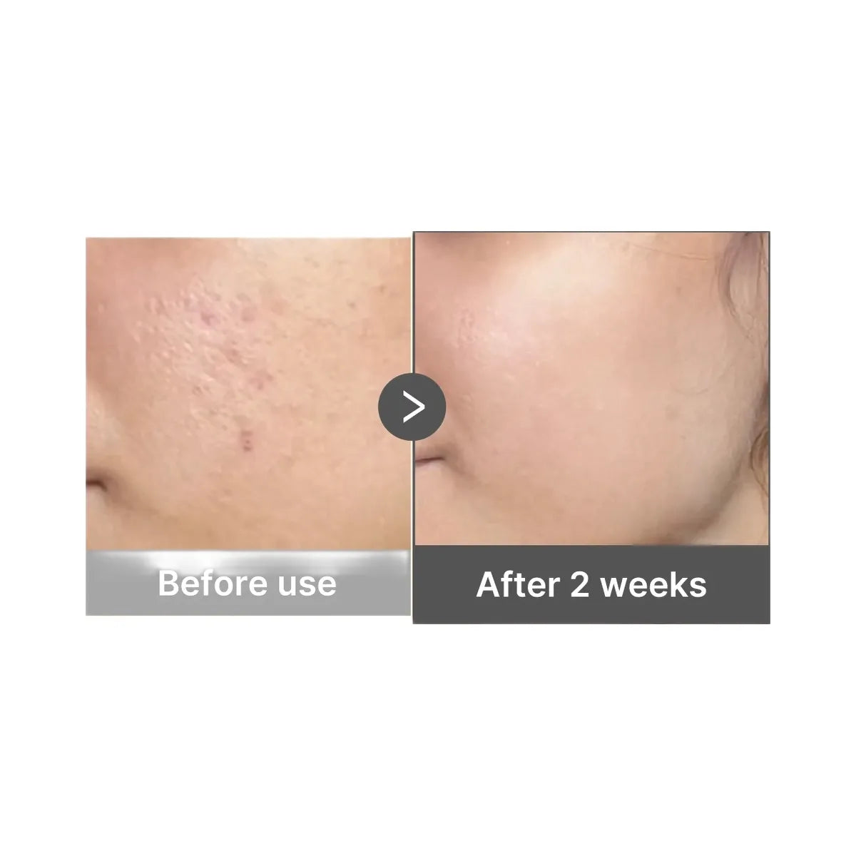 Medicube Kojic Acid Turmeric Capsule Serum