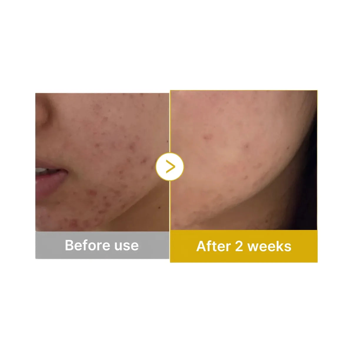 Medicube Kojic Acid Tumeric Toner Pad