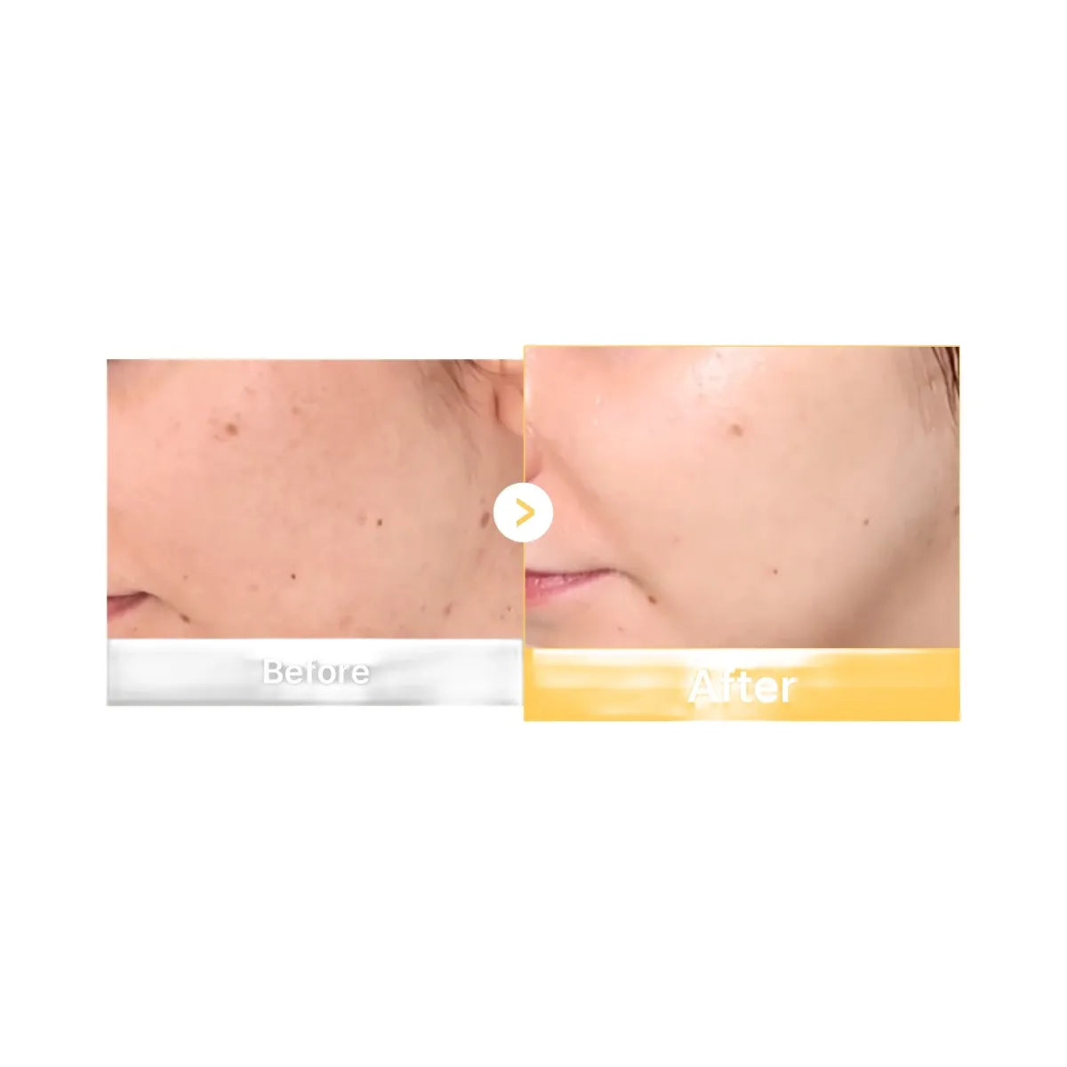 Medicube Kojic Acid Turmeric Gold Jelly Gel Mask