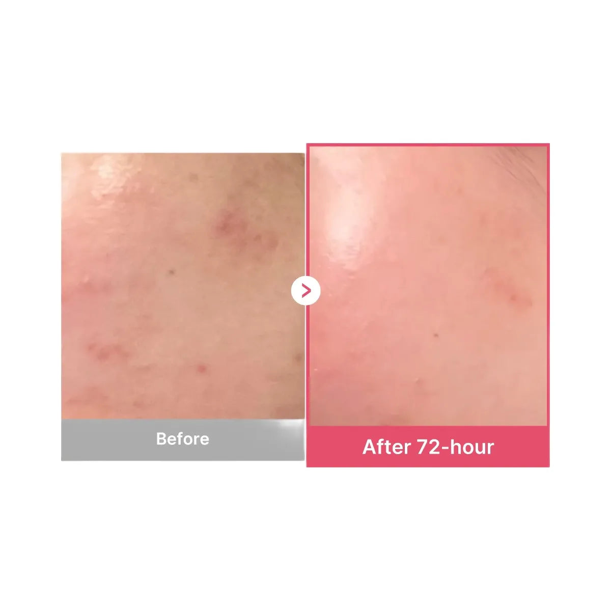 Medicube TXA Niacinamide Serum