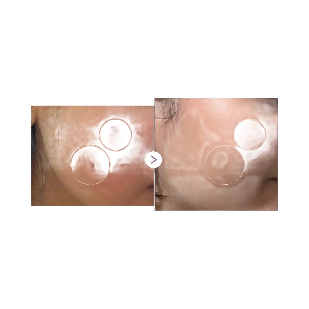 Medicube AGE-R Glutathione Glow Milk Toner