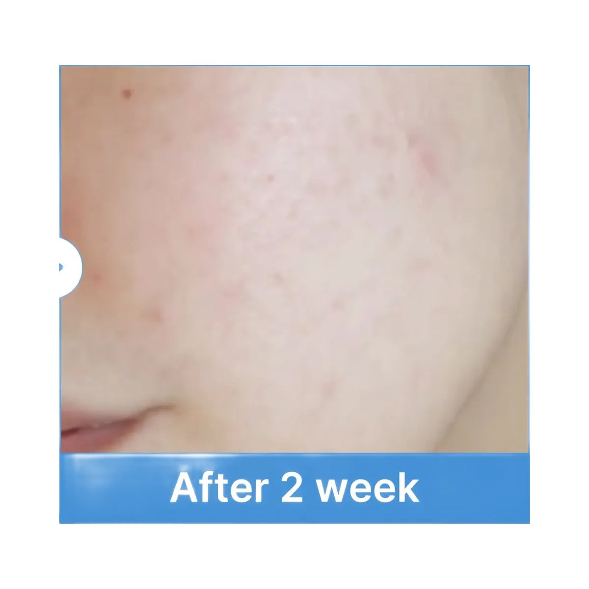 Medicube Zero Pore Toner
