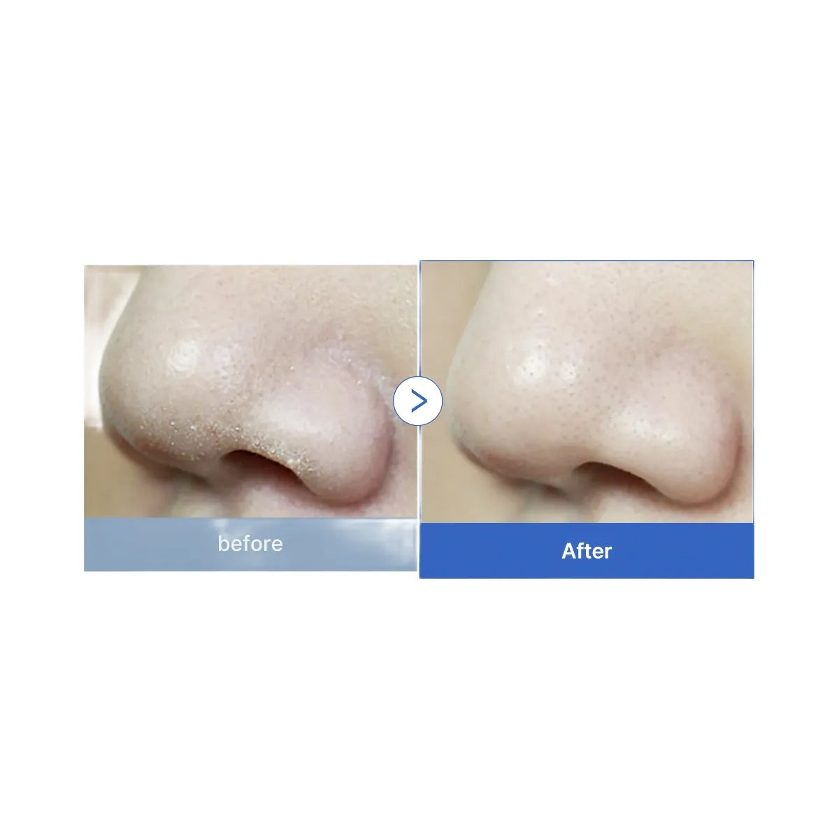 Medicube Zero Foam Cleanser