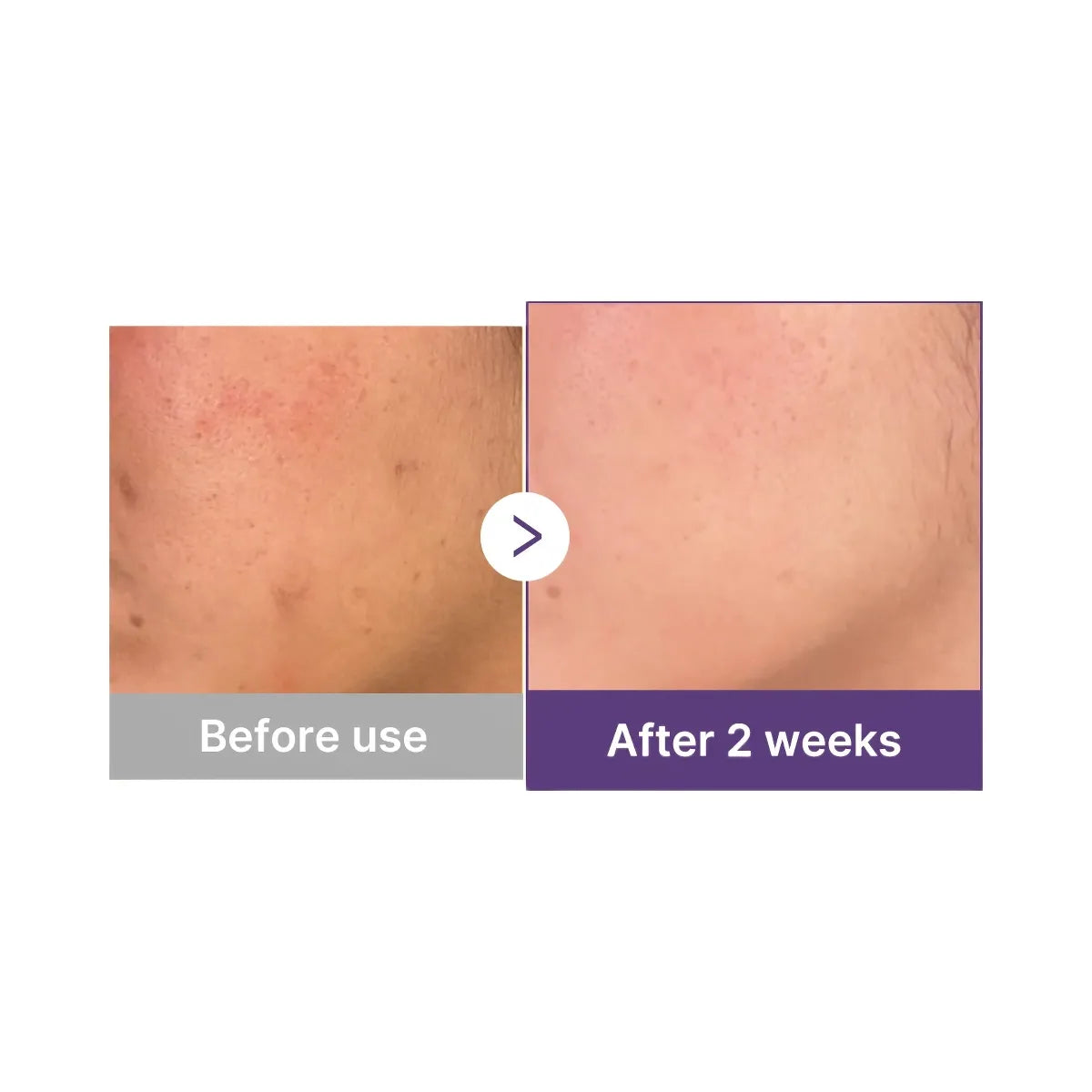 Medicube Retinol NMN Boosting Serum