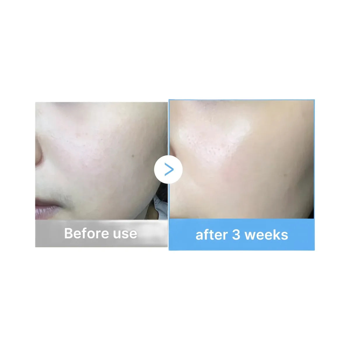 Medicube Hyaluronic Multi Peptide PDRN Serum