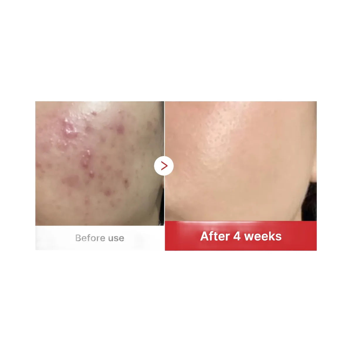 Medicube Red Succinic Acid Panthenol Pads