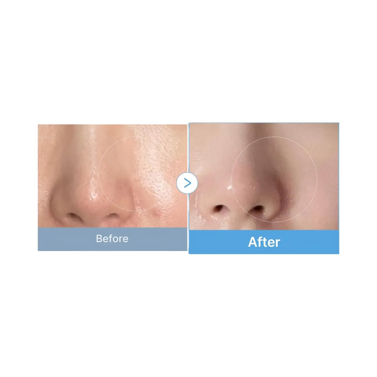 Medicube Zero Pore Madecassoside Pads (Mild)