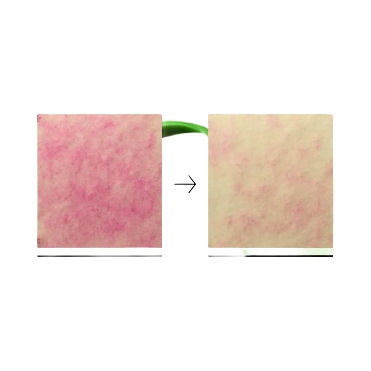 ANUA Azelaic Acid 10 Hyaluron Redness Soothing Pad