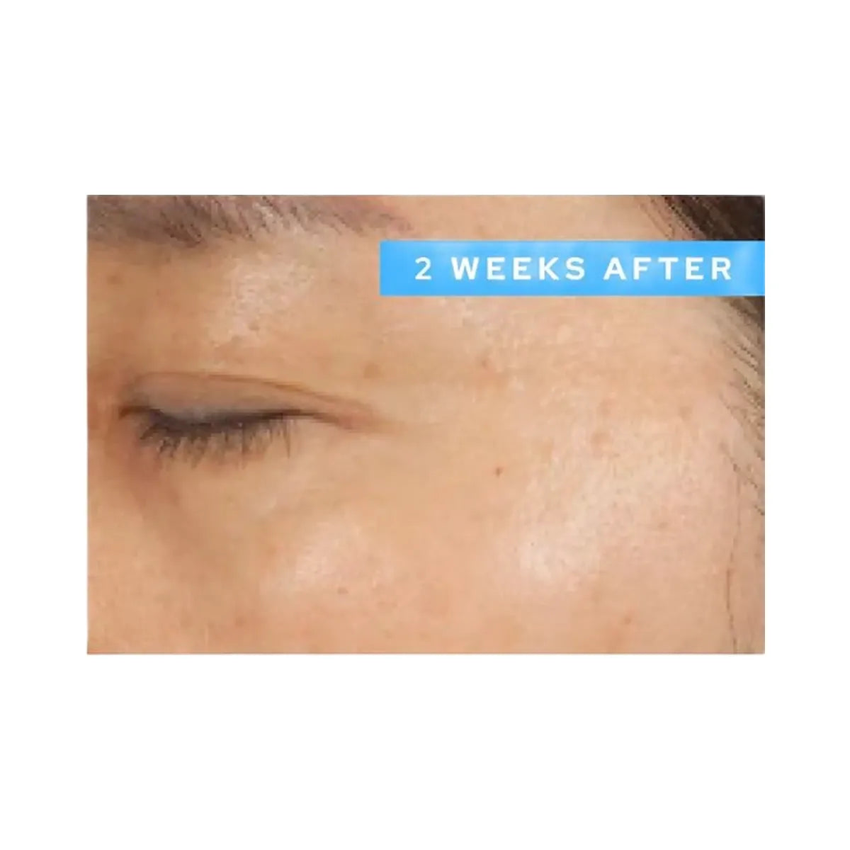 belif Moisturizing Eye Bomb Eye Cream