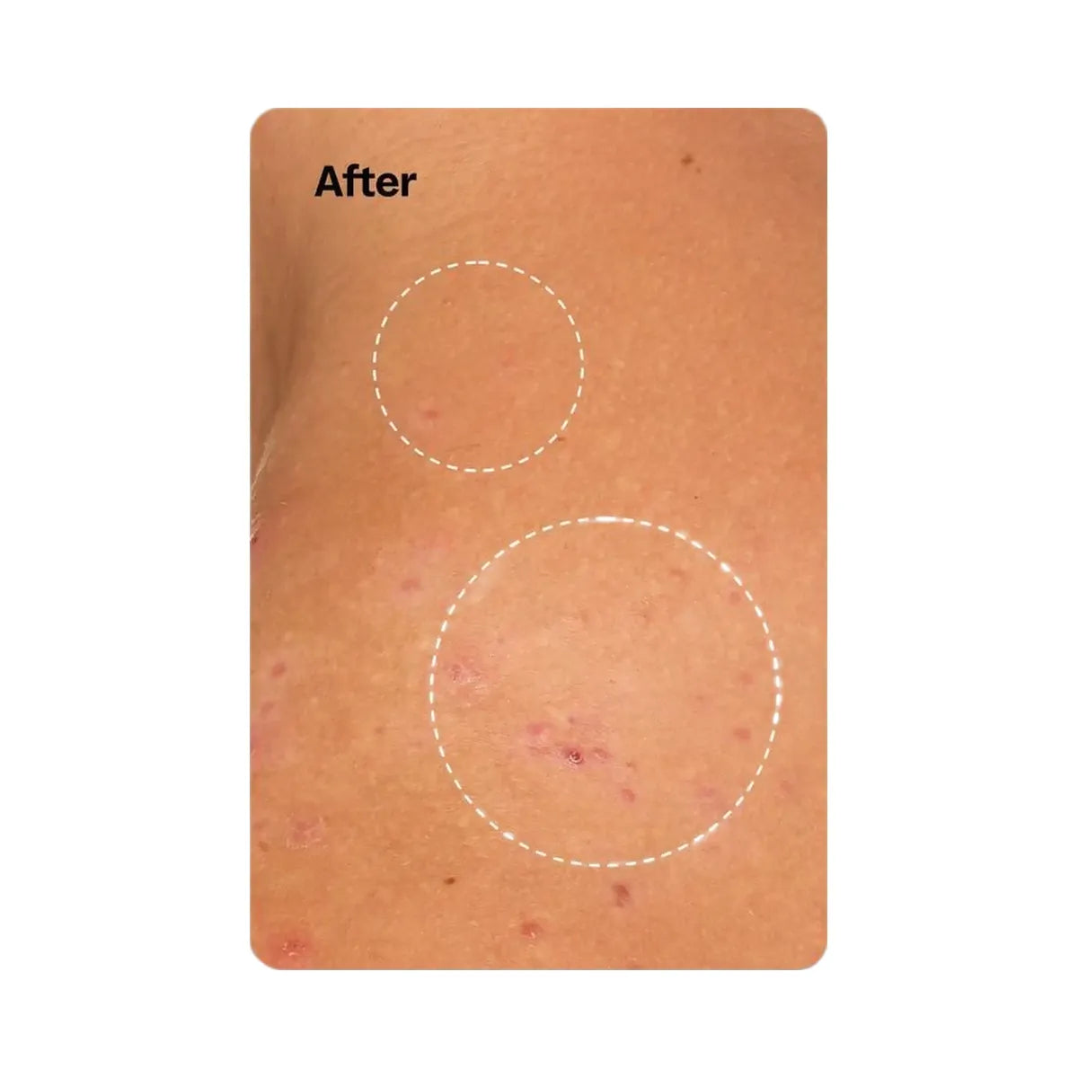 Peach Slices Breakout Banisher Body Spray
