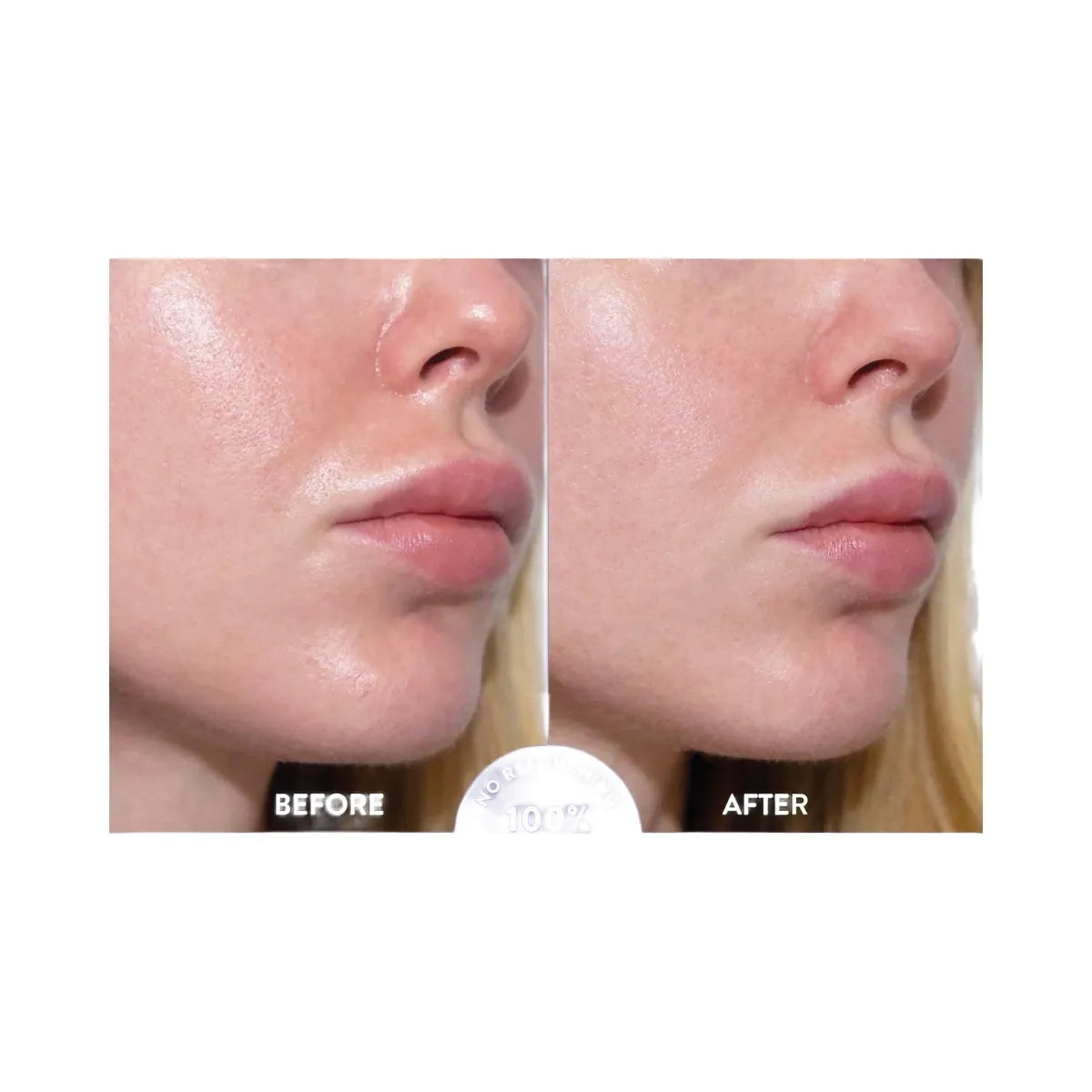 Peach Slices Oil Control Pore Serum