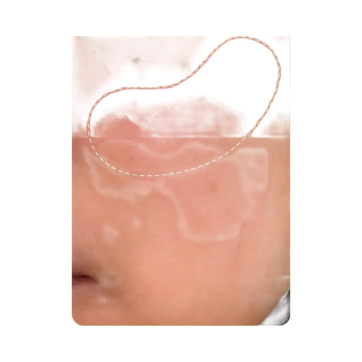 Peach Slices Super Fade Discoloration Serum