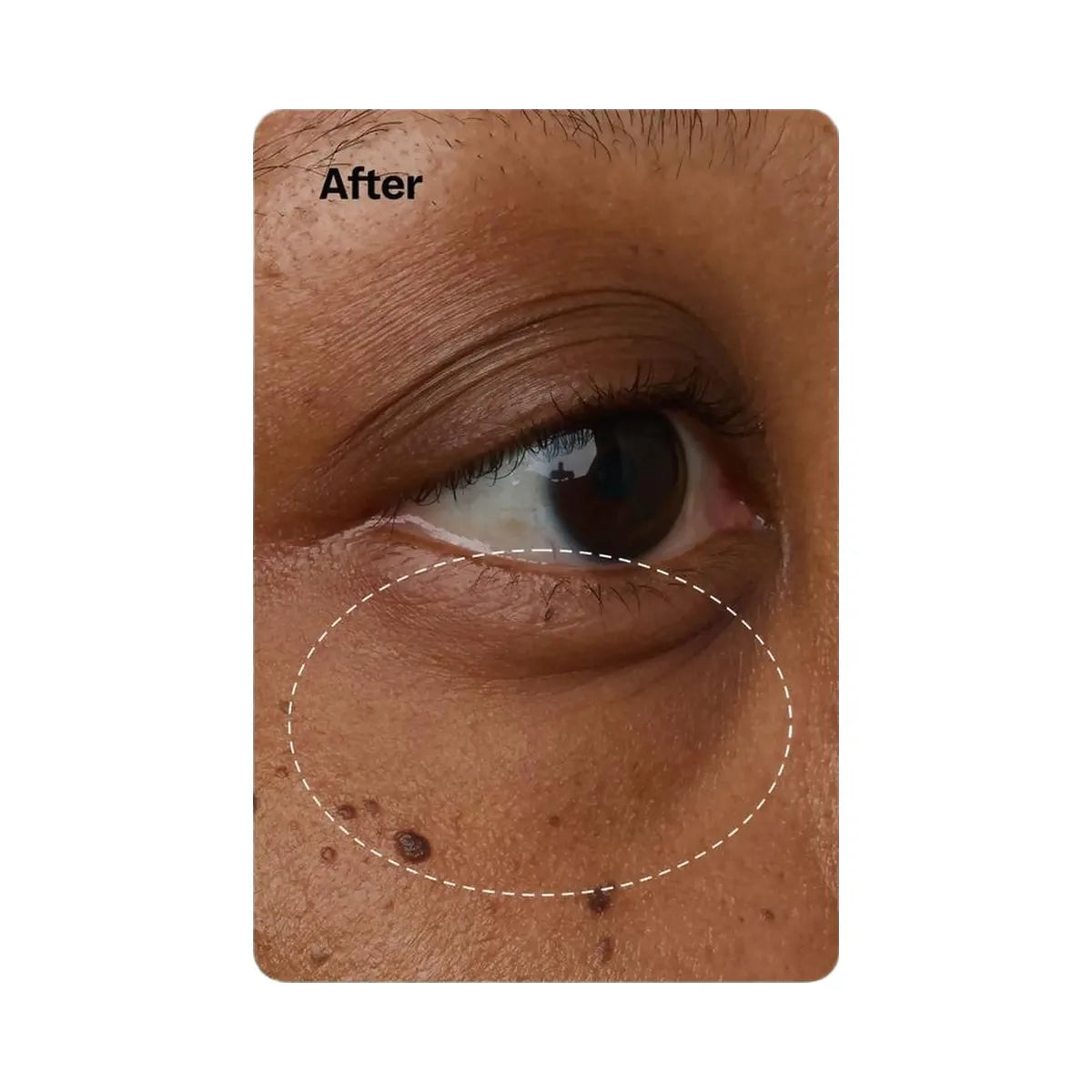 Peach Slices Snail Rescue Ultimate Eye Gel