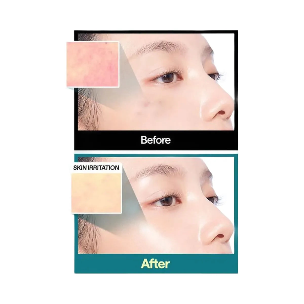 MEDIHEAL Madecassoside Essential Mask