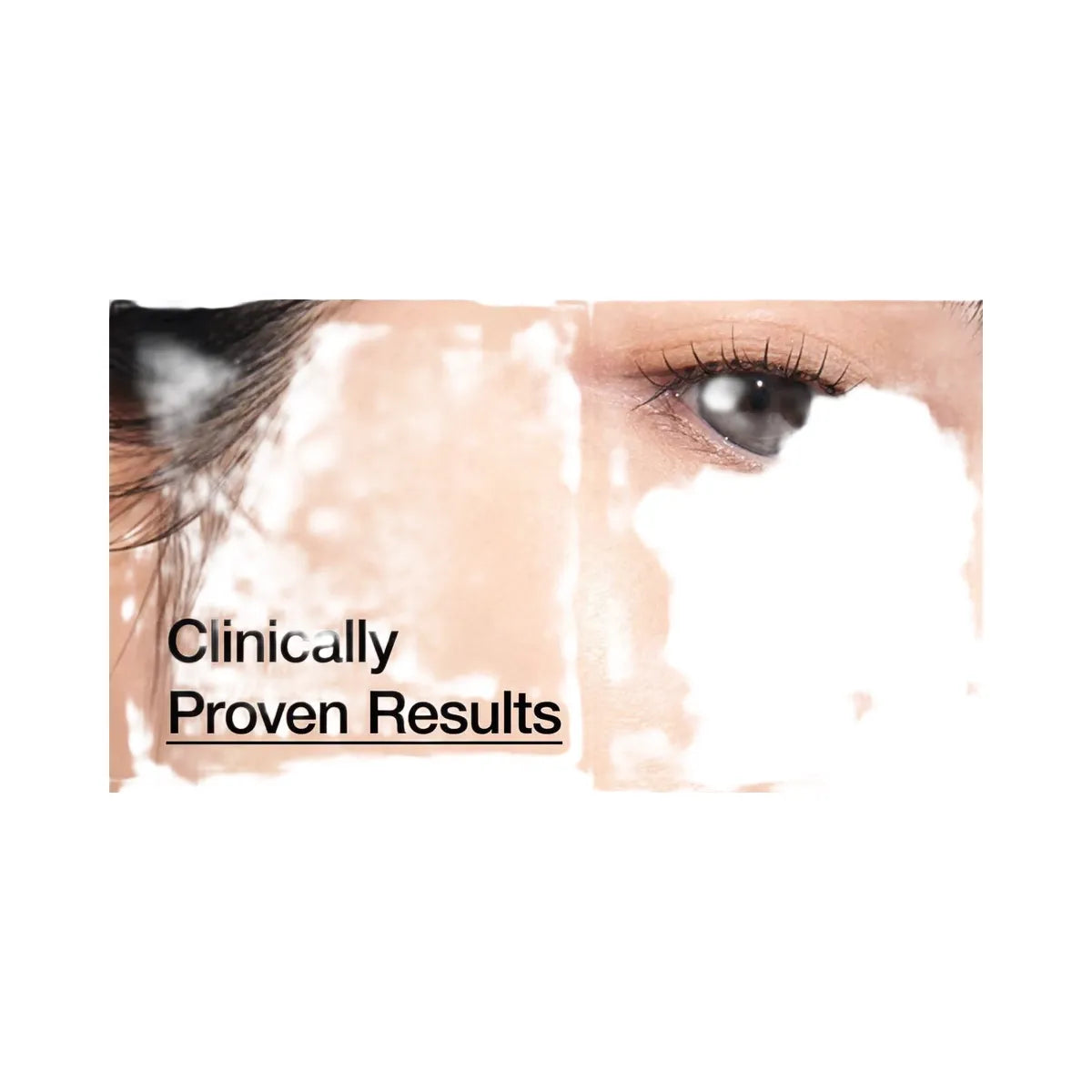 ANUA 7 Rice Ceramide Hydrating Barrier Serum