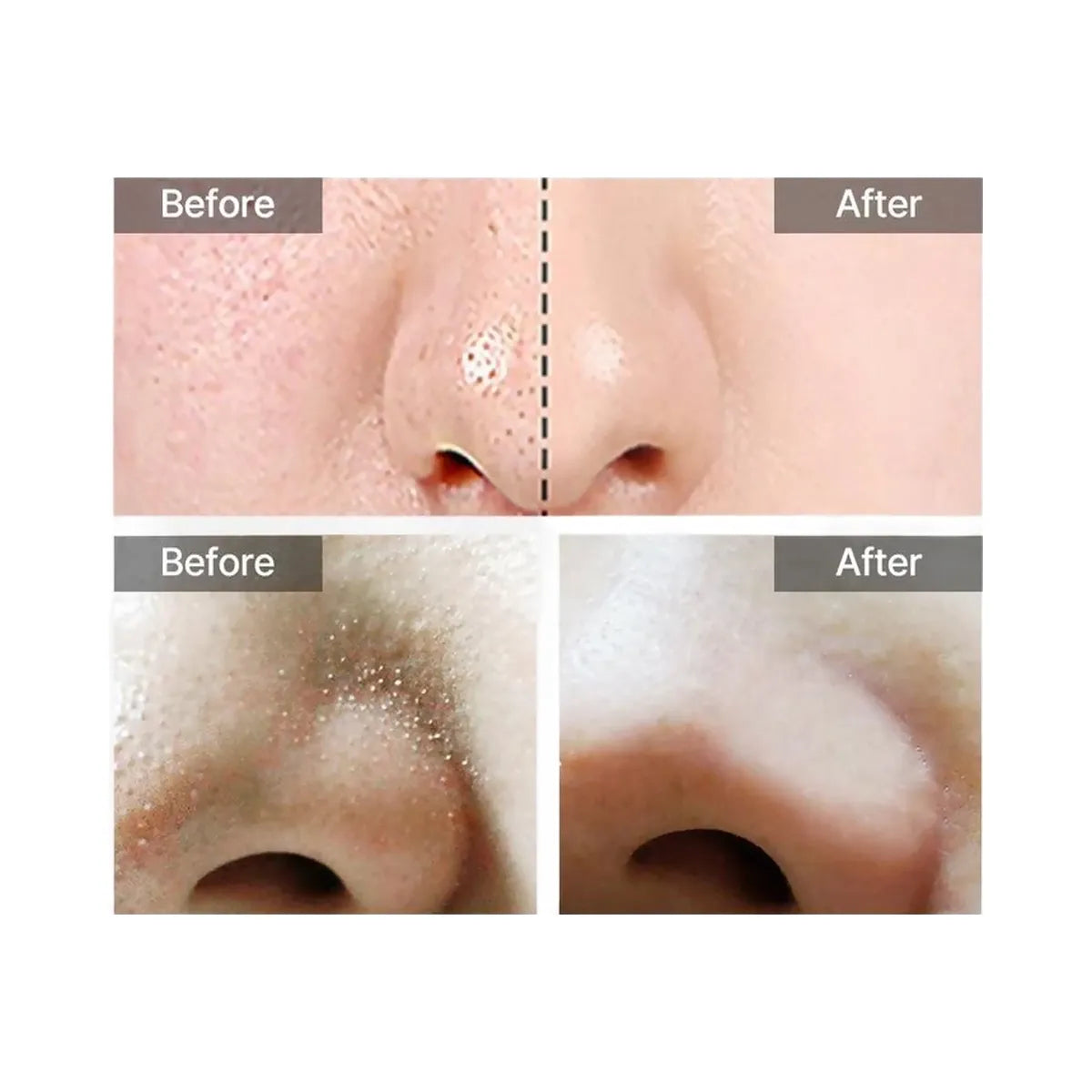 celimax Jiwoogae Heartleaf BHA Peeling & Exfoliating Pads