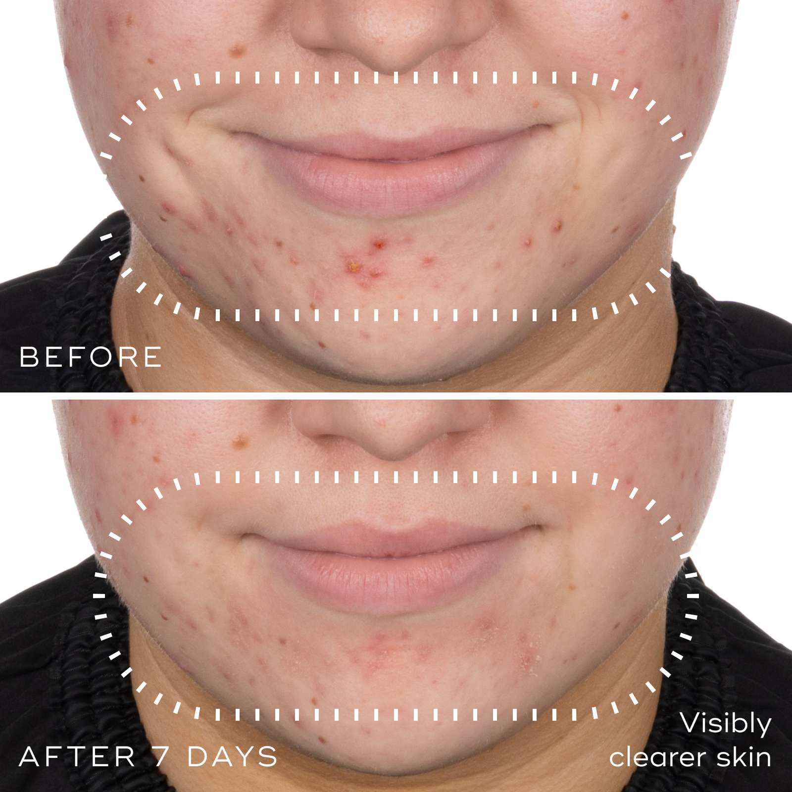 Medik8 Niacinamide Peptides