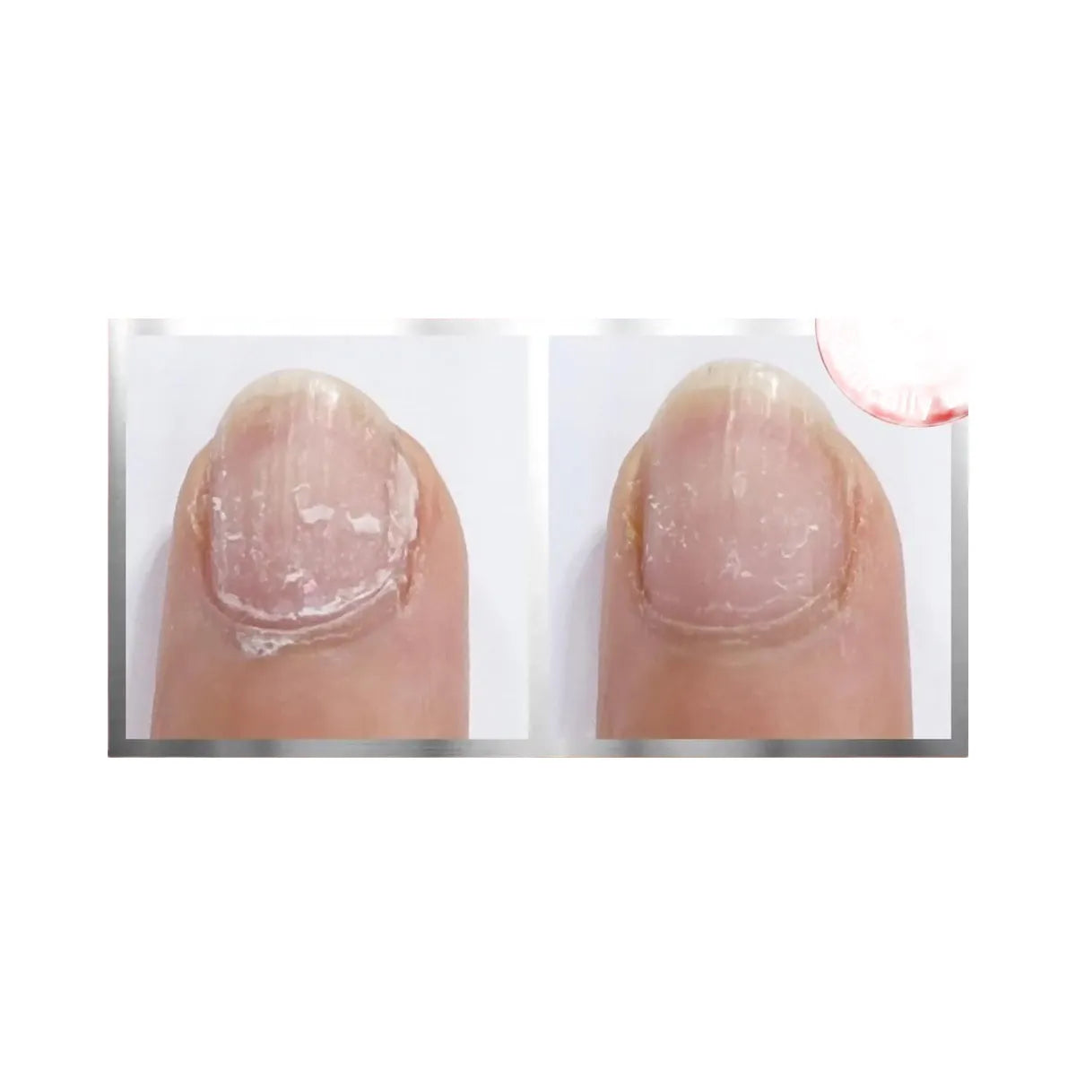 Essie To The Rescue UV Gel Damage Repair