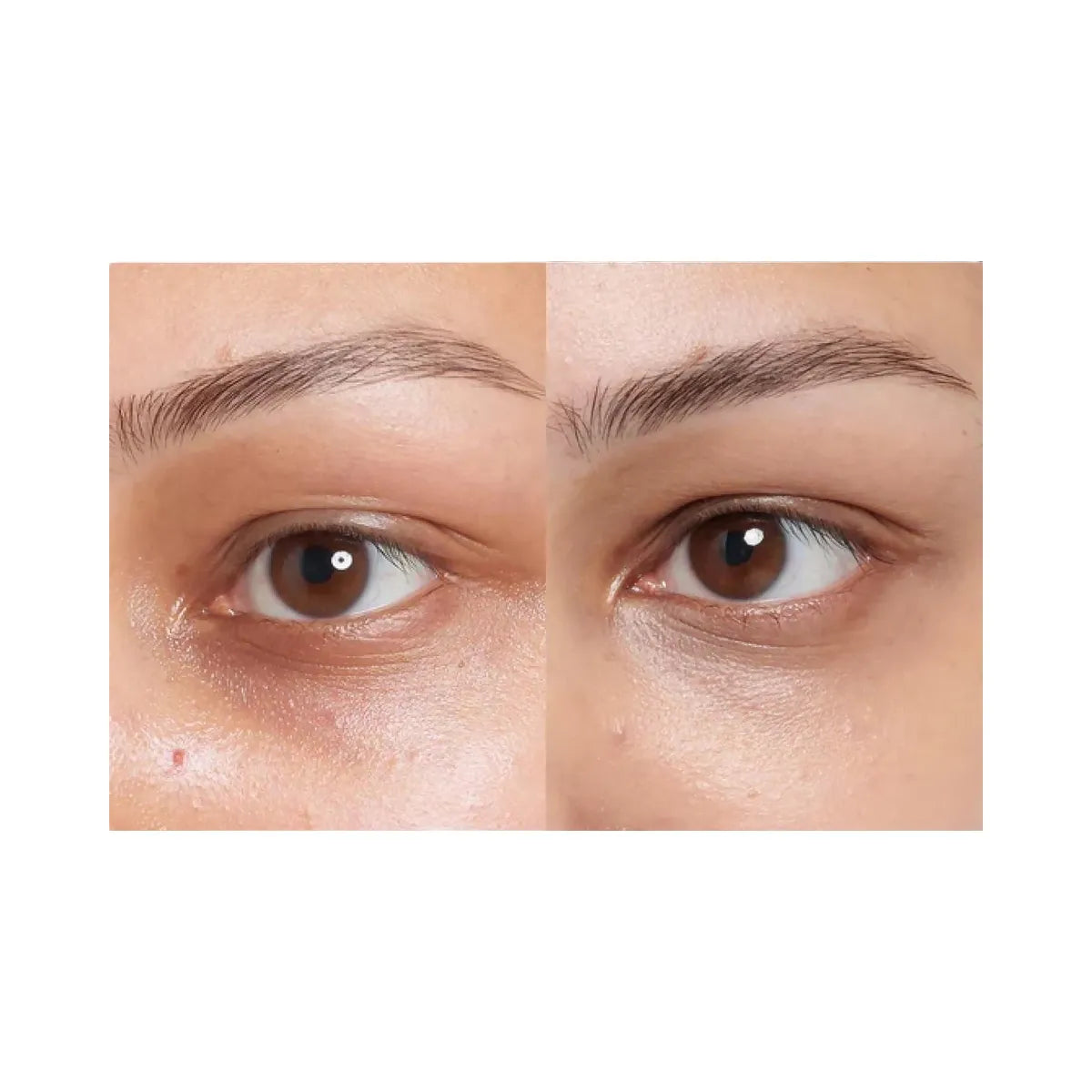 INKEY Caffeine De-puffing + Dark Circle Eye Cream
