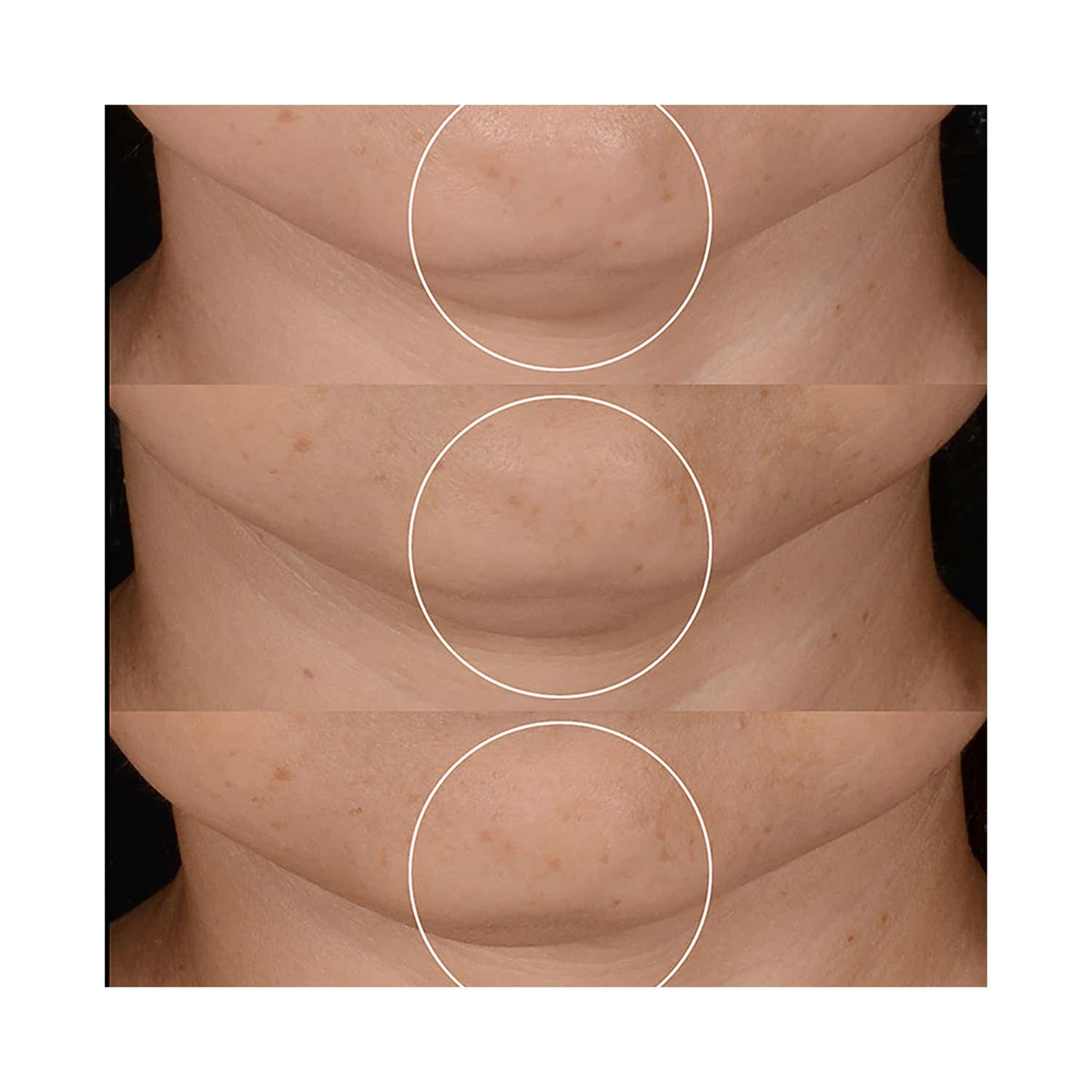 Lancome Renergie Cream (50ml) - Lancome