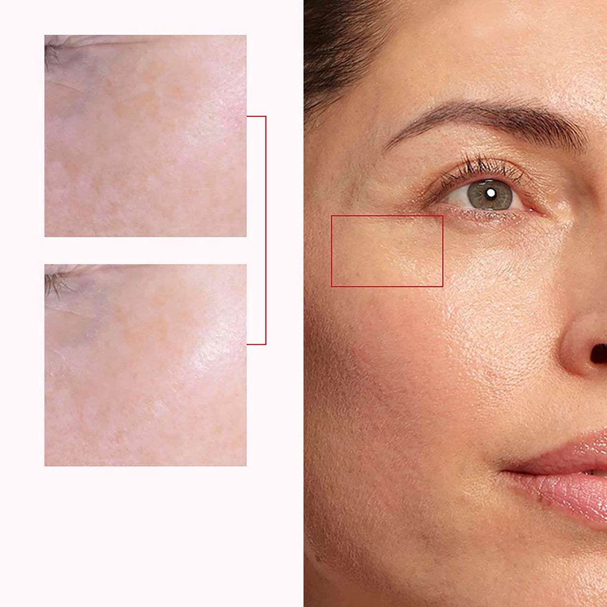 Clarins Super Restorative Rose Radiance Cream (50 ml) - Clarins