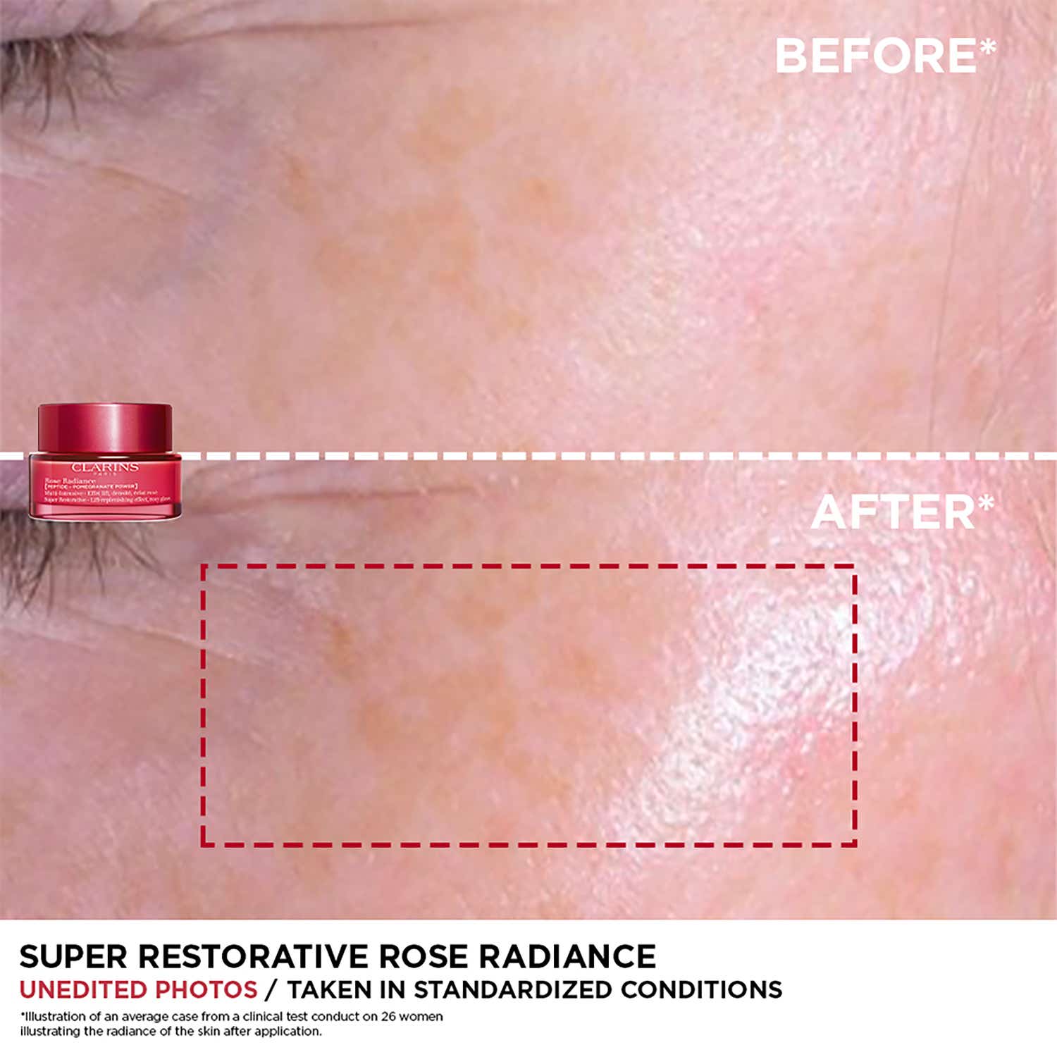 Clarins Super Restorative Rose Radiance Cream (50 ml) - Clarins