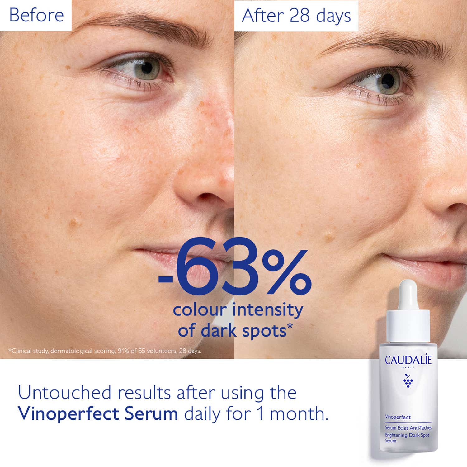 Caudalie Vinoperfect Serum and Suncare Set (2 pcs) - Caudalie