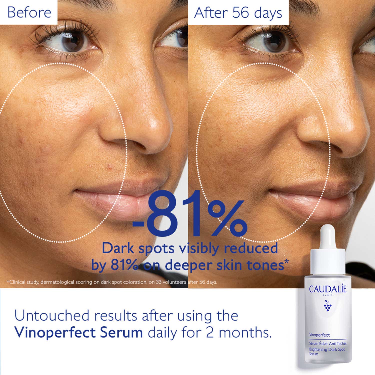 Caudalie Vinoperfect Serum and Suncare Set (2 pcs) - Caudalie